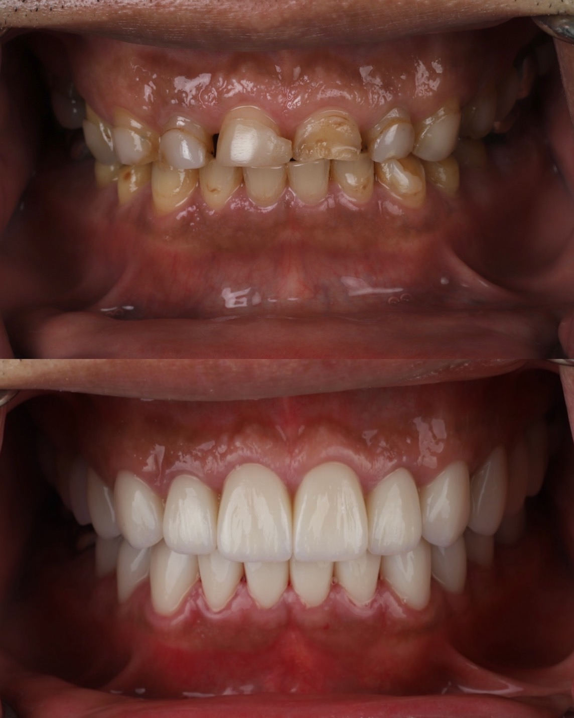 Before and After Case 1