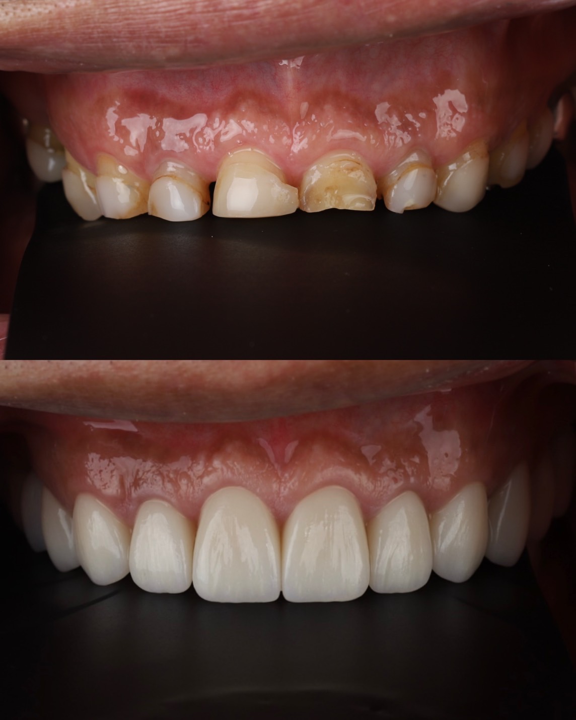 Before and After Case 1