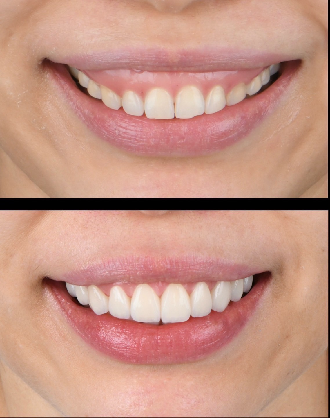 Before and After Case 1