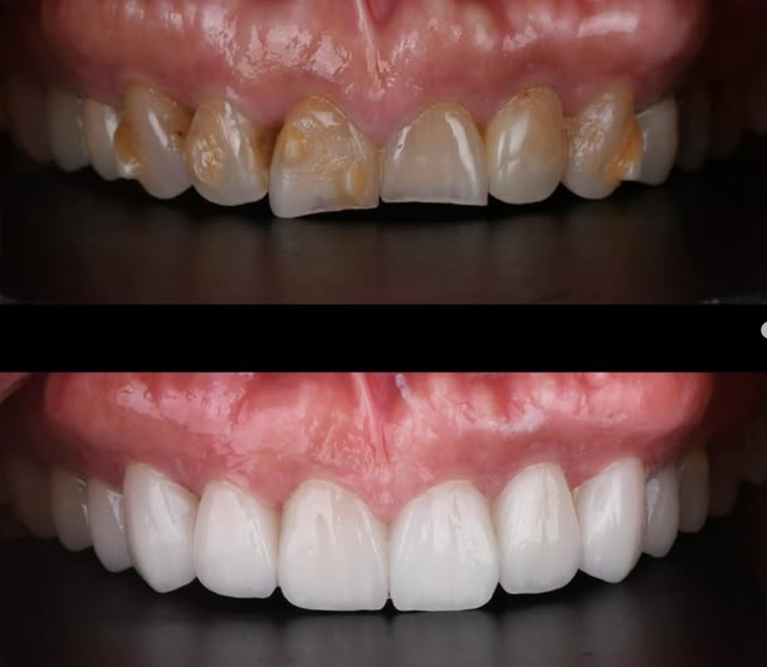 Before and After Case 1