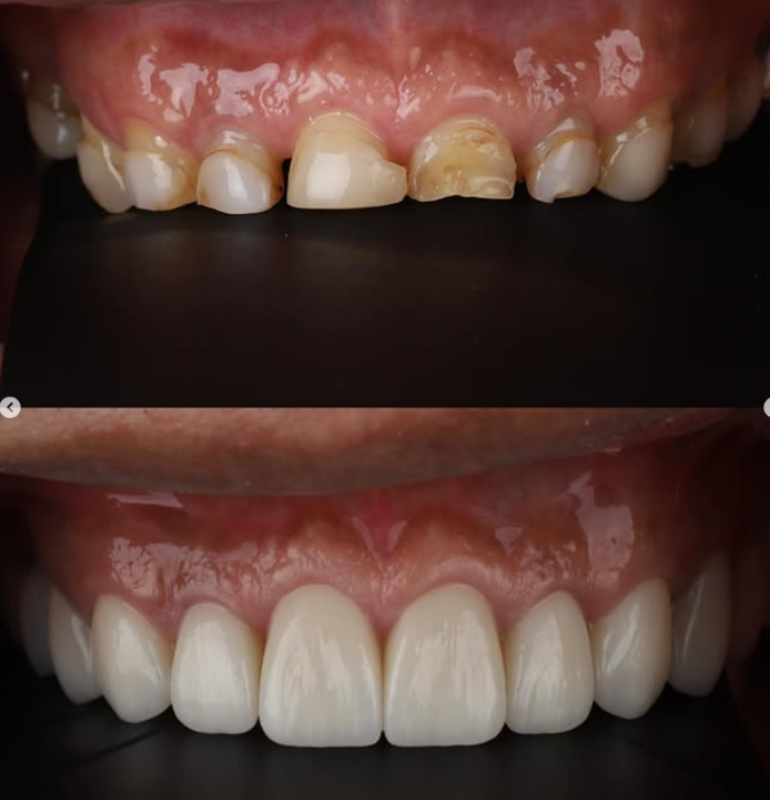 Before and After Case 1