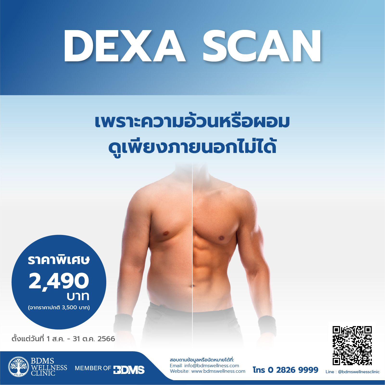 Dexa Scan