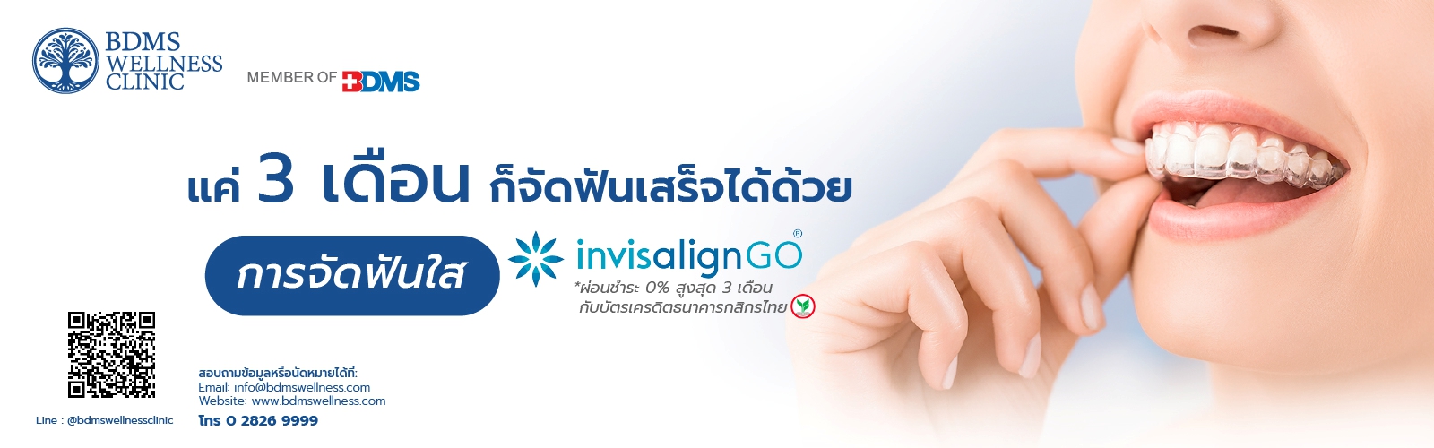 Invisalign GO จัดฟันใสใน 3 เดือน