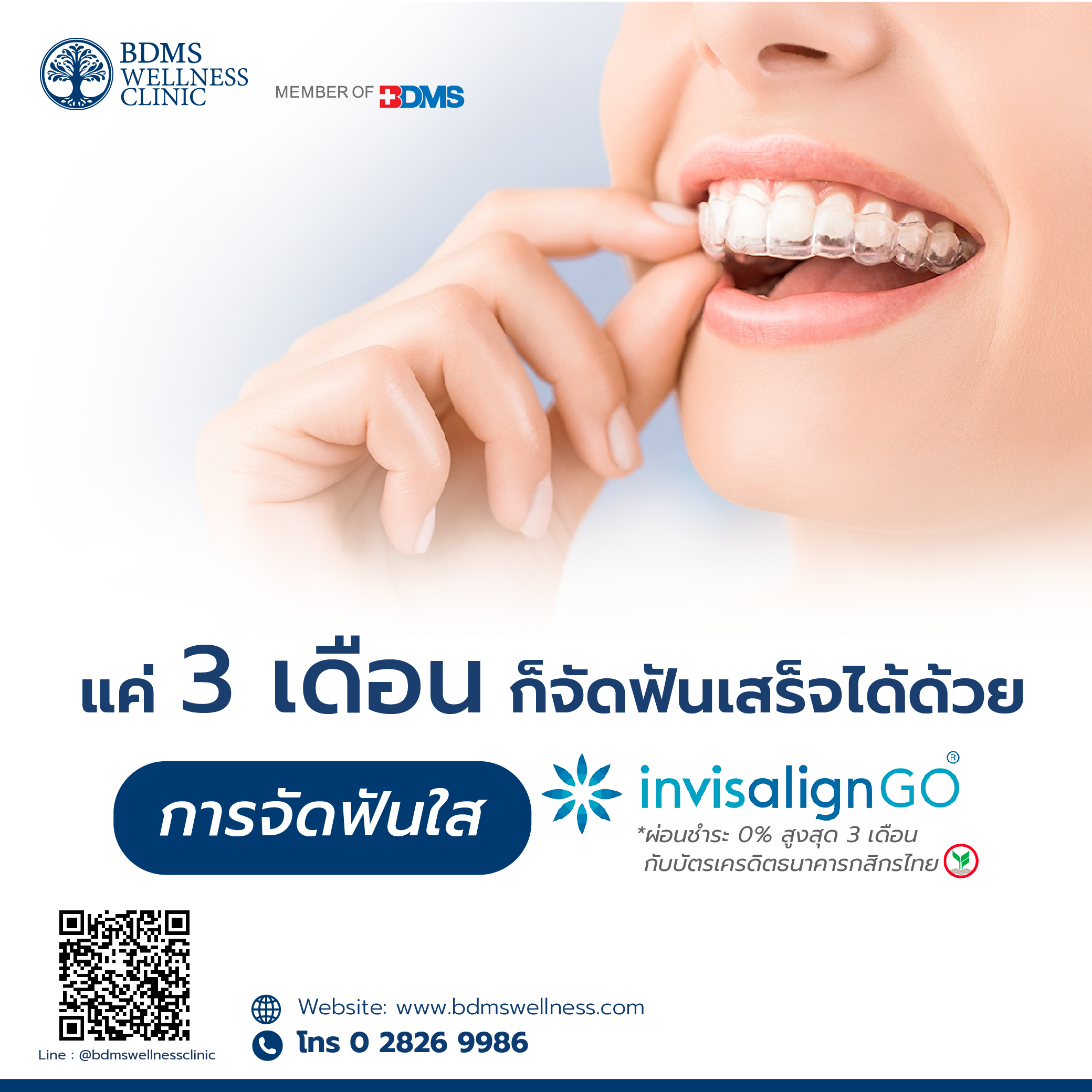 Invisalign GO จัดฟันใสใน 3 เดือน