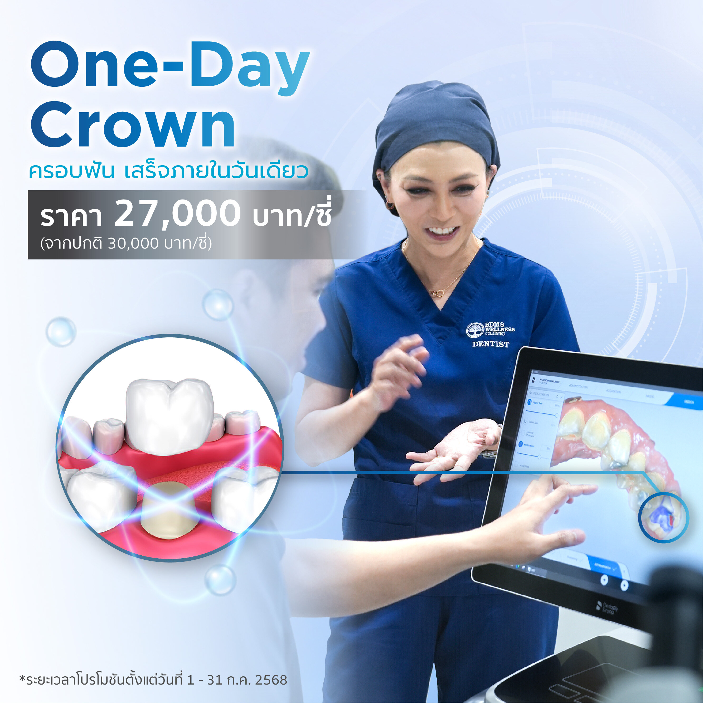 One-Day Crown ครอบฟันสวยในวันเดียวด้วยระบบดิจิทัล ราคาพิเศษ 27,000 บาท/ซี่ (จากปกติ 30,000 บาท) ในงาน Smile Upgrade Month BDMS Wellness Clinic ถนนวิทยุ โปรโมชั่นถึง 31 ก.ค.